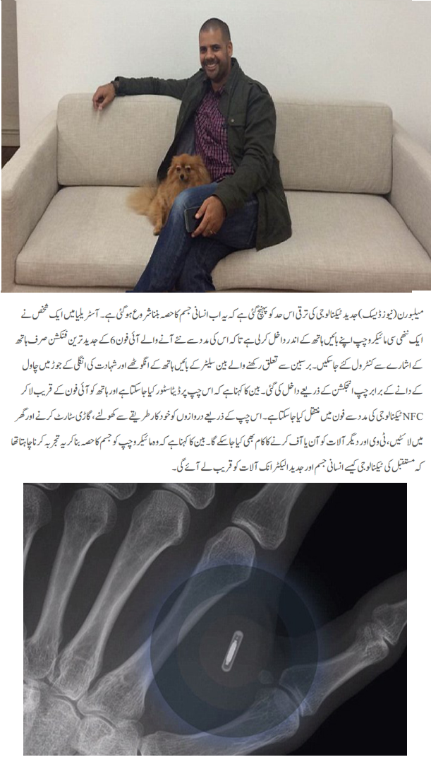 Man Got Chip in his hand to make more use of iPhone 6